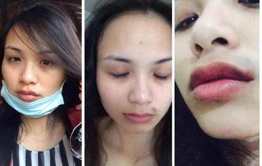 Trước siêu mẫu Khả Trang, nhiều hoa hậu, người mẫu từng tố bị chồng đánh đập tàn nhẫn - Ảnh 5.