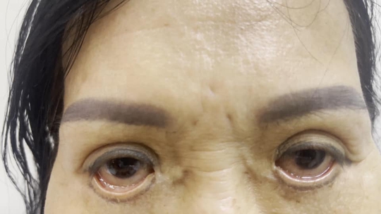 Ám ảnh đôi mắt của người phụ nữ đến từ Bình Dương - Ảnh 1.