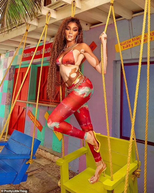 Siêu mẫu Winnie Harlow khoe đường cong “đốt cháy” ngày hè - Ảnh 1.