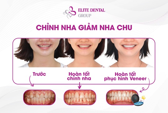 Hành trình sở hữu nụ cười khỏe đẹp toàn diện có gian nan không? - Ảnh 2.