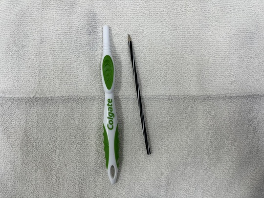 Hi hữu bàn chải đánh răng và ruột bút bi trong dạ dày nam bệnh nhân - Ảnh 3.