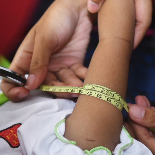 Suy dinh dưỡng vẫn là một thách thức lớn đối với trẻ em Đông Nam Á - Ảnh 2.