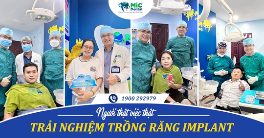 Trồng răng Implant - giải pháp công nghệ tối ưu tại MIC - Ảnh 2.