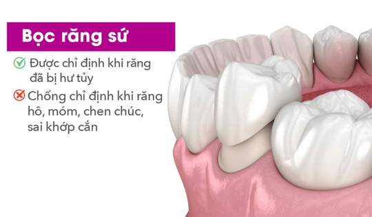 3 điều bạn cần biết để làm đẹp nụ cười an toàn - Ảnh 1.