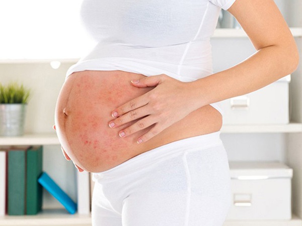 Mụn vùng kín khi mang thai có ảnh hưởng đến thai nhi không?
