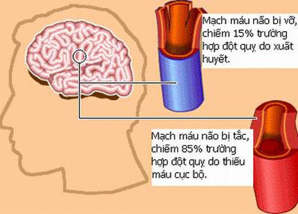 Ai nên sử dụng thuốc bổ não xê rê?
