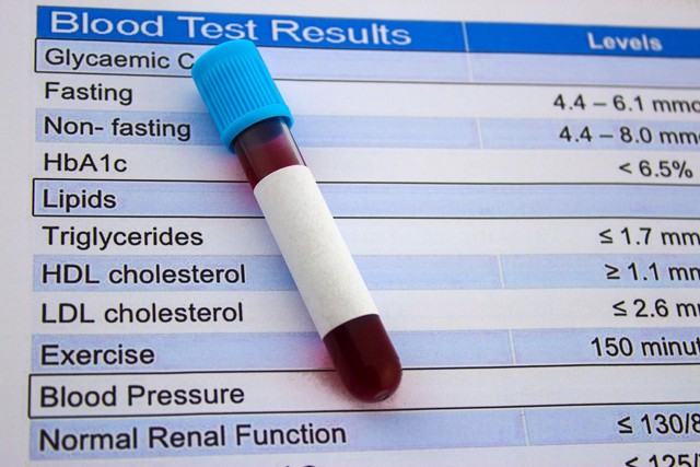 Chỉ số HDL-cholesterol được thể hiện qua kết quả xét nghiệm máu thông thường Ảnh: HARVARD HEALTH Chỉ số HDL-cholesterol được thể hiện qua kết quả xét nghiệm máu thông thường Ảnh: HARVARD HEALTH
