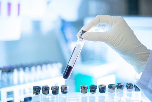 Xét nghiệm máu phát hiện sớm đa ung thư của công ty Grail trên lộ trình xin được FDA cấp phép.- Ảnh 1.