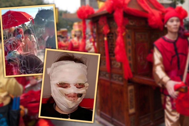 Cô dâu Trung Quốc bỏng kín mặt vì trò vui trong đám cưới- Ảnh 1.