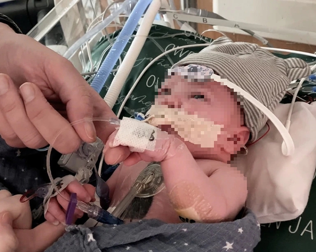 Em bé đầu tiên trên thế giới sống khỏe nhờ ghép một phần trái tim- Ảnh 1.