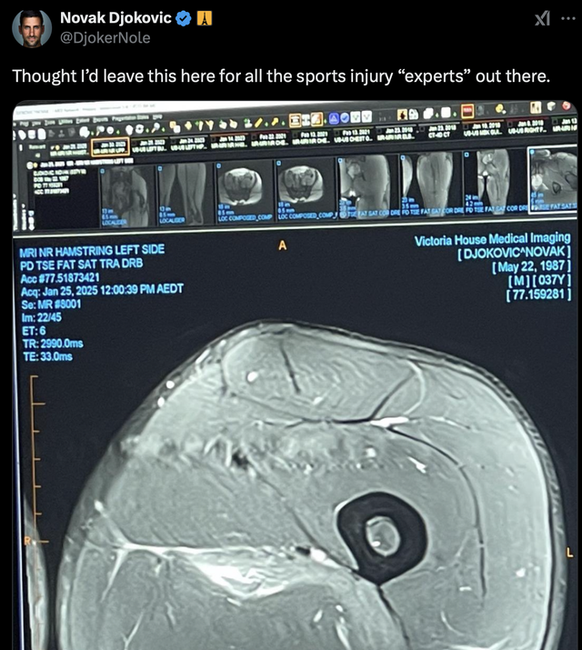 Djokovic gửi thông điệp đến ai hoài nghi chấn thương của anh- Ảnh 1.