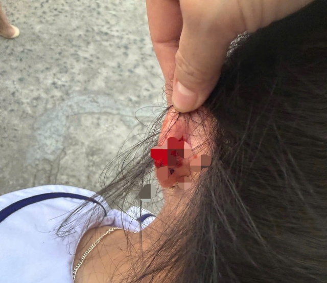 Xác minh vụ cô giáo ở Phú Quốc nhéo tai học sinh đến chảy máu - Ảnh 1.