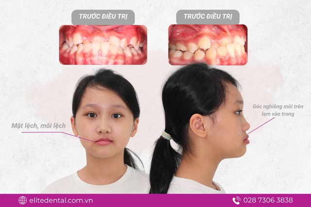 Con móm di truyền từ mẹ: mẹ có thể giúp con "đảo ngược" số phận- Ảnh 1. Con móm di truyền từ mẹ: mẹ có thể giúp con "đảo ngược" số phận- Ảnh 1.