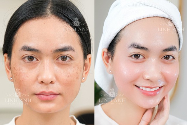 Chọn chuẩn, an tâm trẻ hóa da tại Thẩm mỹ viện Linh Anh- Ảnh 1. Chọn chuẩn, an tâm trẻ hóa da tại Thẩm mỹ viện Linh Anh- Ảnh 1.