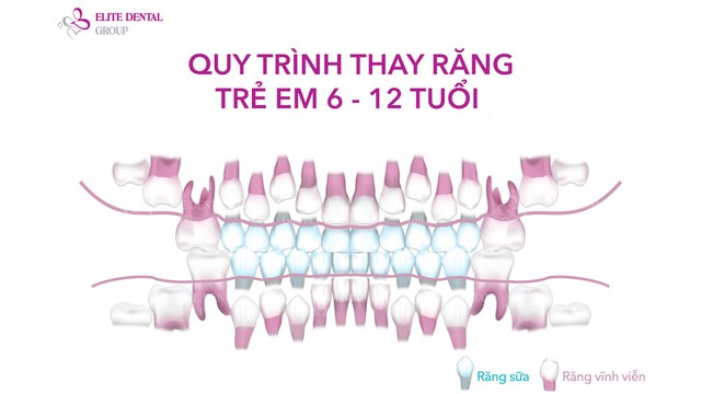 Chỉnh nha sớm cho trẻ: can thiệp đúng lúc – tiết kiệm chi phí- Ảnh 2.
