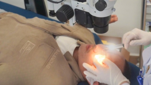Nam thanh niên bỏng mắt vì keo trám tường- Ảnh 2.