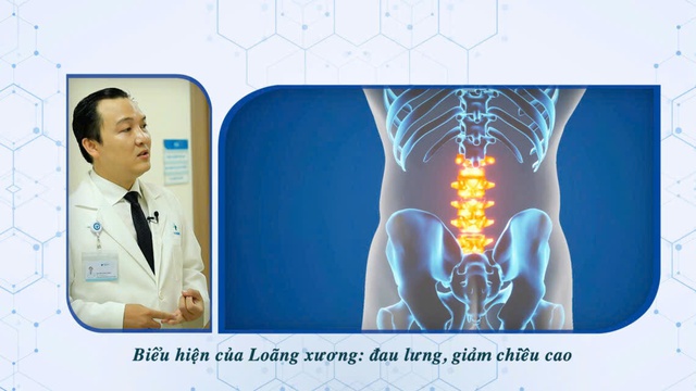 Chịu đựng gù lưng, khó đi lại 5 năm chỉ vì sợ mổ cột sống - Ảnh 2.