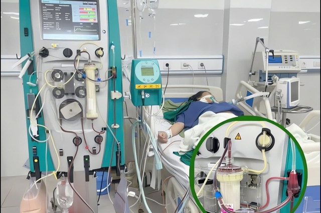 Mổ bắt con khẩn cấp, lọc máu cứu sản phụ vì biến chứng bất ngờ- Ảnh 2. Mổ bắt con khẩn cấp, lọc máu cứu sản phụ vì biến chứng bất ngờ- Ảnh 2.