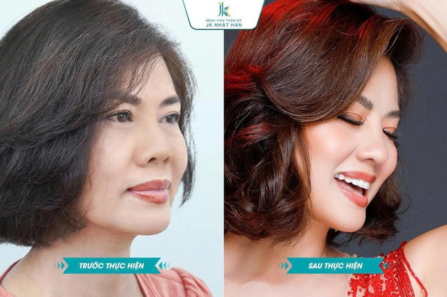 Nghệ sĩ đứng sau ánh đèn: Hồ Lệ Thu và hành trình “Vì sống là sẻ chia” - Ảnh 3.