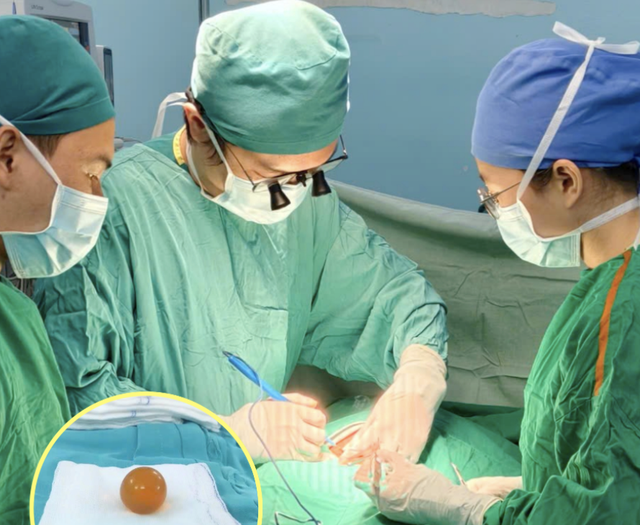 Bác sĩ cảnh báo nguy cơ Từ hạt đồ chơi gây tắc ruột ở trẻ em - Ảnh 1. Bác sĩ cảnh báo nguy cơ Từ hạt đồ chơi gây tắc ruột ở trẻ em - Ảnh 1.