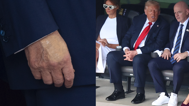 Nhà Trắng thông báo Tổng thống Donald Trump mắc suy tĩnh mạch mạn tính- Ảnh 1. Nhà Trắng thông báo Tổng thống Donald Trump mắc suy tĩnh mạch mạn tính- Ảnh 1.