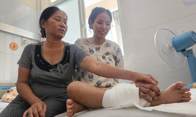Ghép bàn tay vào chân cho cô gái 18 tuổi mang song thai để chờ ngày nối lại- Ảnh 1.
