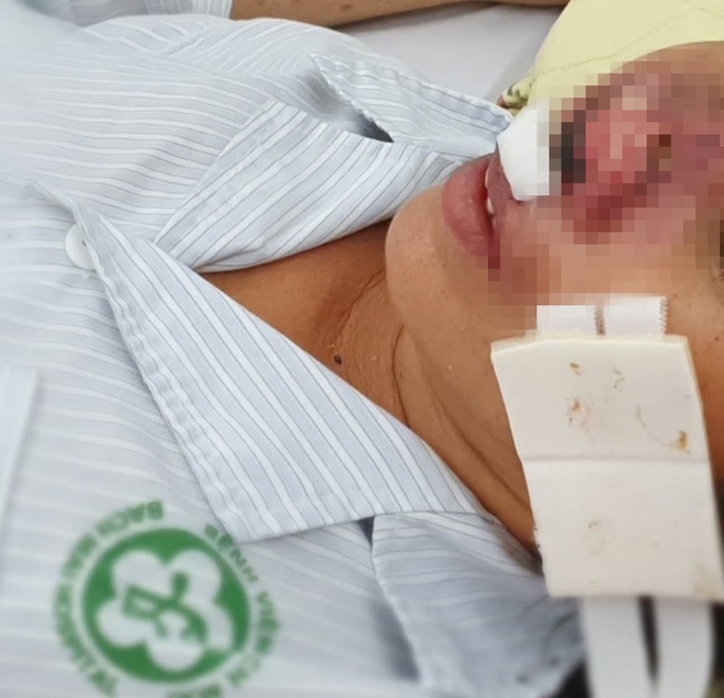 Sự thật kh&oacute; ngờ về vi khuẩn "ăn thịt người"- Ảnh 10.