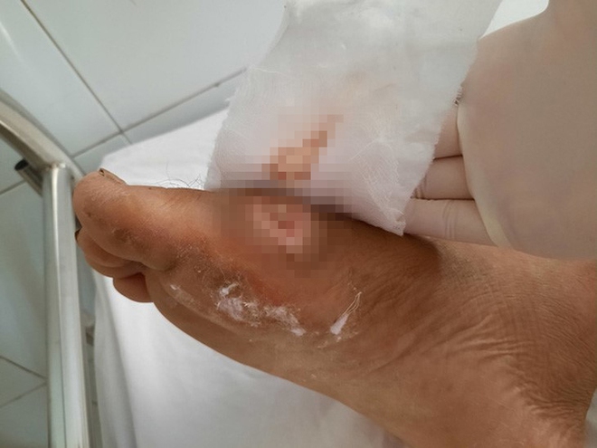 Sự thật kh&oacute; ngờ về vi khuẩn "ăn thịt người"- Ảnh 13.