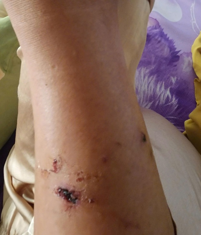 Vũng T&agrave;u: Khỉ tr&ecirc;n N&uacute;i Lớn rượt đuổi, tấn c&ocirc;ng người - Ảnh 3.