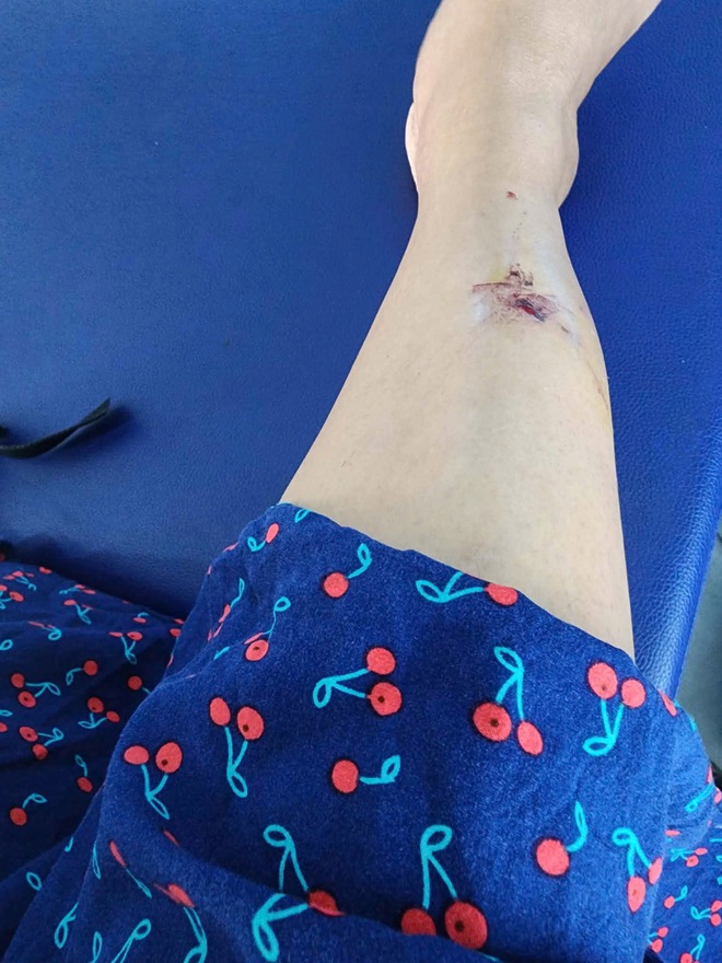 Vũng T&agrave;u: Khỉ tr&ecirc;n N&uacute;i Lớn rượt đuổi, tấn c&ocirc;ng người - Ảnh 2.