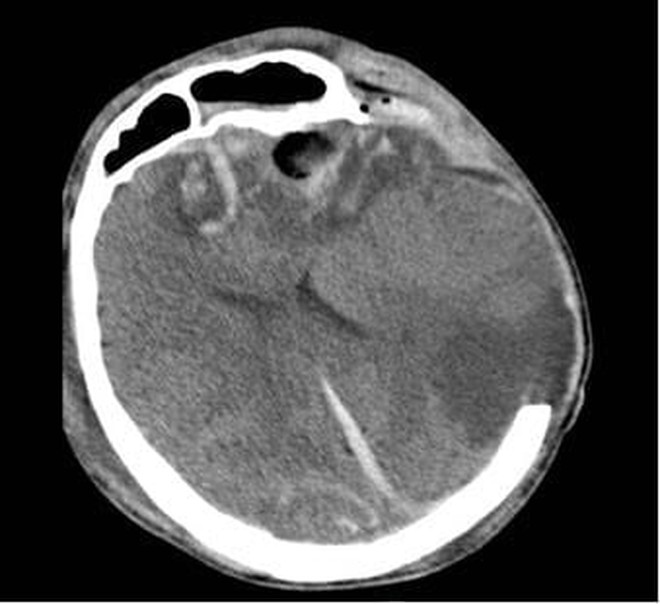 Cứu sống mẹ con du kh&aacute;ch Nga bị tai nạn nghi&ecirc;m trọng tại TPHCM - Ảnh 1.
