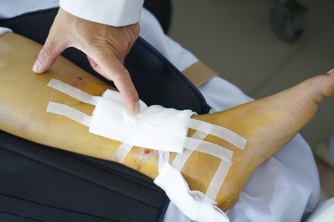 Cứu nam t&agrave;i xế c&ocirc;ng nghệ đa chấn thương nặng sau tai nạn tr&ecirc;n đường Phạm Ngũ L&atilde;o - Ảnh 1.