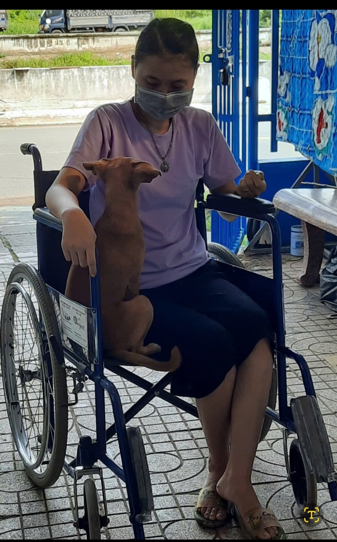 D&ugrave;ng corticoid điều trị vi&ecirc;m da, người phụ nữ bị hoại tử khớp h&aacute;ng phải ngồi xe lăn - Ảnh 2.