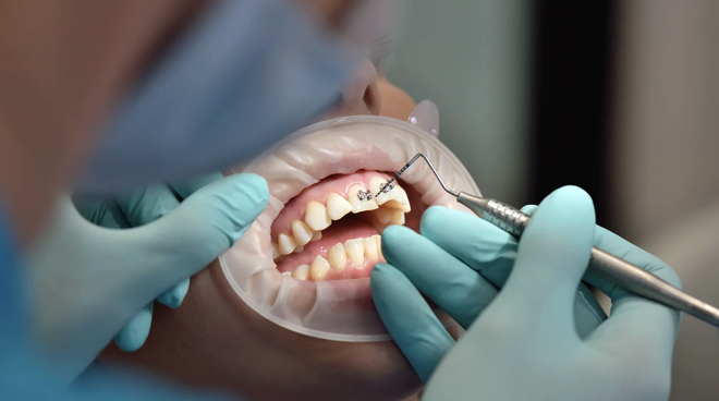 Mỗi h&agrave;m răng một ph&aacute;c đồ ri&ecirc;ng nhờ nha khoa c&aacute; nh&acirc;n h&oacute;a - Ảnh 2.