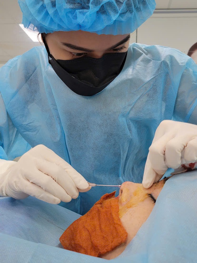 Phẫu thuật thẩm mỹ biến chứng gia tăng: Chế t&agrave;i chưa đủ sức răn đe - Ảnh 4.