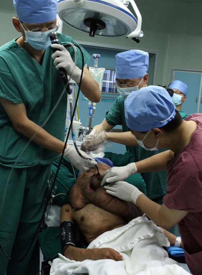 Các bác sĩ đang thực hiện ca phẫu thuật cắt bỏ khối u cho Huang
