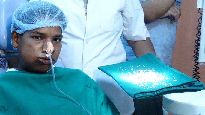 Ashik Gavai và số răng được lấy ra từ miệng cậu bé sau phẫu thuật