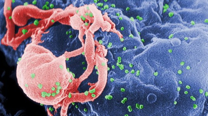 Hình ảnh HIV sống trong tế bào bạch huyết qua kính hiển vi điện tử - Ảnh Fox News