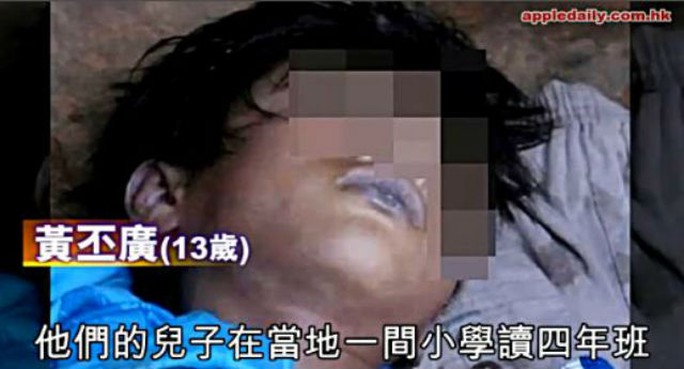 Thi thể nam sinh Huang Pi-guang bầm tím và có nhiều vết sẹo 