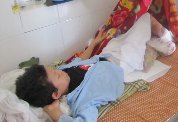 Cháu Thành bị bỏng nặng trên 40% hiện đang nằm điều trị tại Bệnh viện đa khoa Hà Tĩnh.