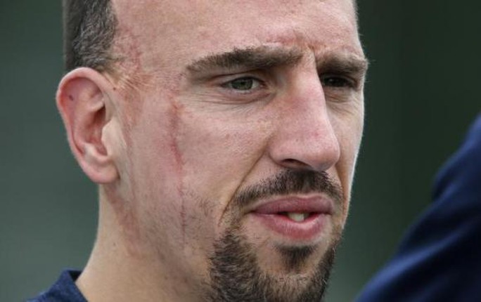 Quả bóng đồng 2014 Franck Ribery
