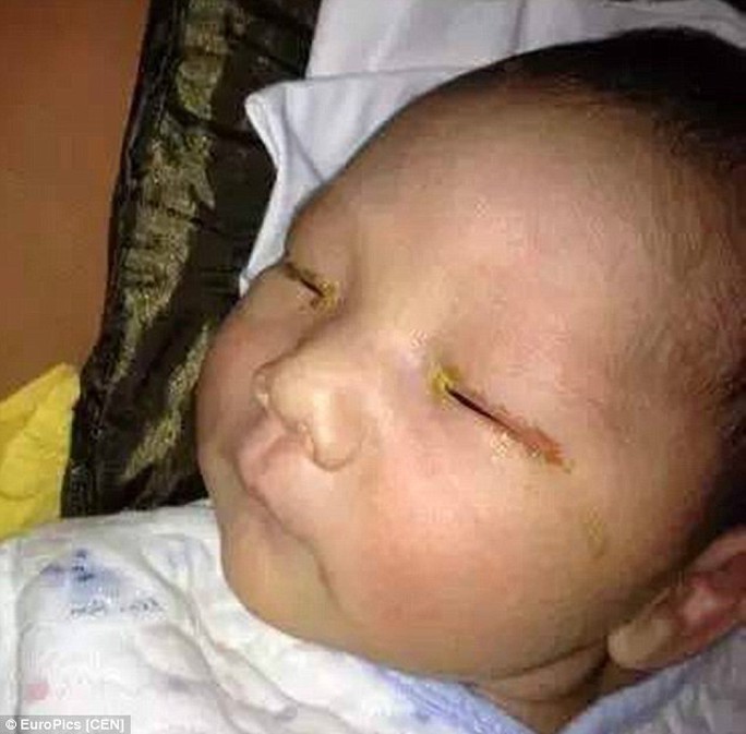 A three-month-old baby, above, has been left blind after a family friend forgot to turn off the flash on a camera 