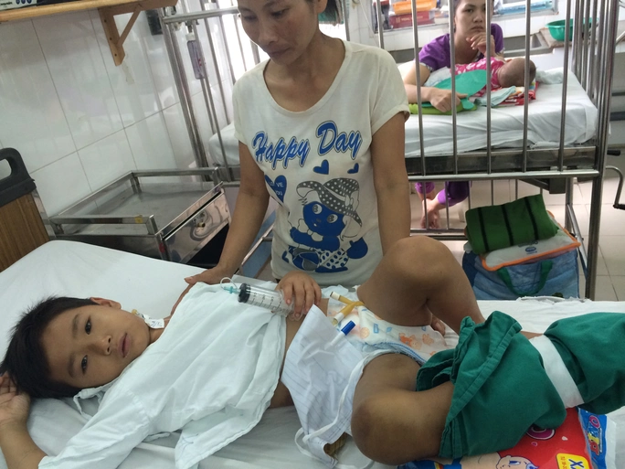 Một bệnh nhân đang điều trị bị rắn lục đuôi đỏ cắn tại Bệnh viện Nhi Đồng 1, TP HCM.