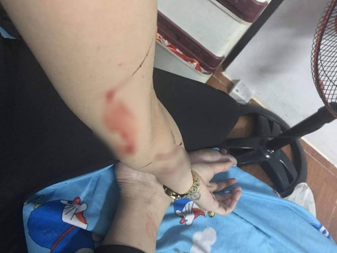 Thiếu nữ D. cho biết 0 giờ ngày 21-2, bị 2 thanh niên lạ mặt áp sát gần hẻm 134 Đào Duy Anh, quận Phú Nhuận (TP HCM) sàm sỡ và rạch tay.