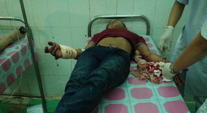 
Nạn nhân đã được sơ cứu ban đầu tại Bệnh viện Đa khoa huyện Vĩnh Thuận. Ảnh: CTV
