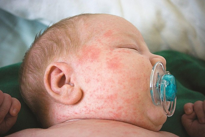 Nhiều thay đổi bất ngờ về tiêm chủng vắc-xin cho mẹ và bé - Ảnh 2.