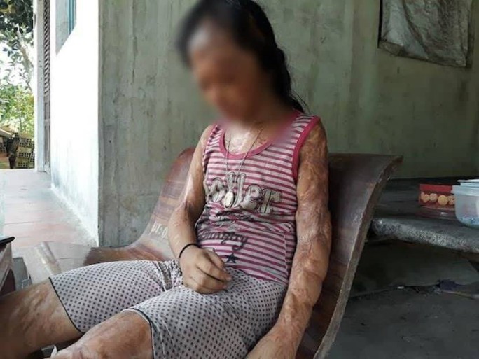 Gặp bà nội bé gái bị tạt axít xin đôi mắt của tử tù Nguyễn Hữu Tình - Ảnh 1.