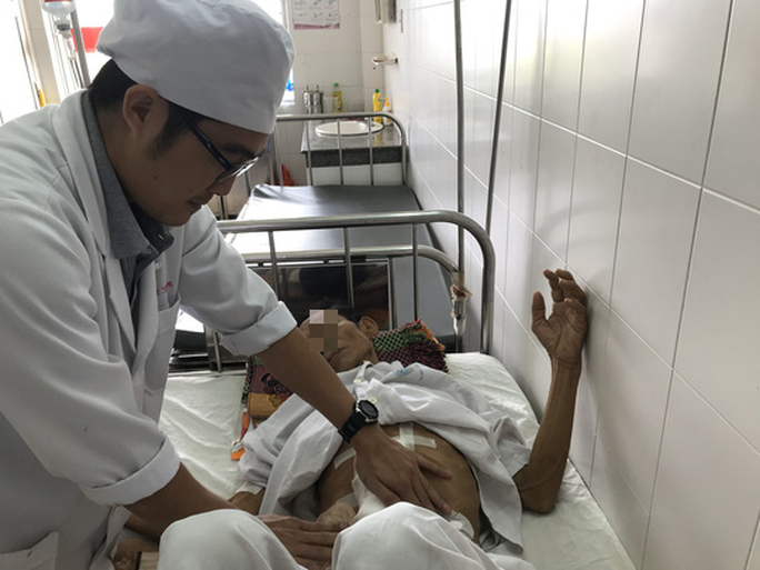 Hi hữu lấy nhiều viên sỏi dạng san hô trong ống tụy bệnh nhân ung thư - Ảnh 2. Hi hữu lấy nhiều viên sỏi dạng san hô trong ống tụy bệnh nhân ung thư - Ảnh 2.