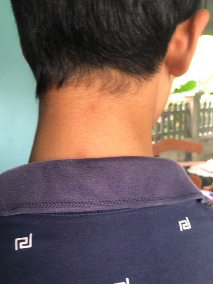 Con mâu thuẫn ở trường, bố kéo người tới đánh tới tấp học sinh lớp 8 - Ảnh 1. Con mâu thuẫn ở trường, bố kéo người tới đánh tới tấp học sinh lớp 8 - Ảnh 1.