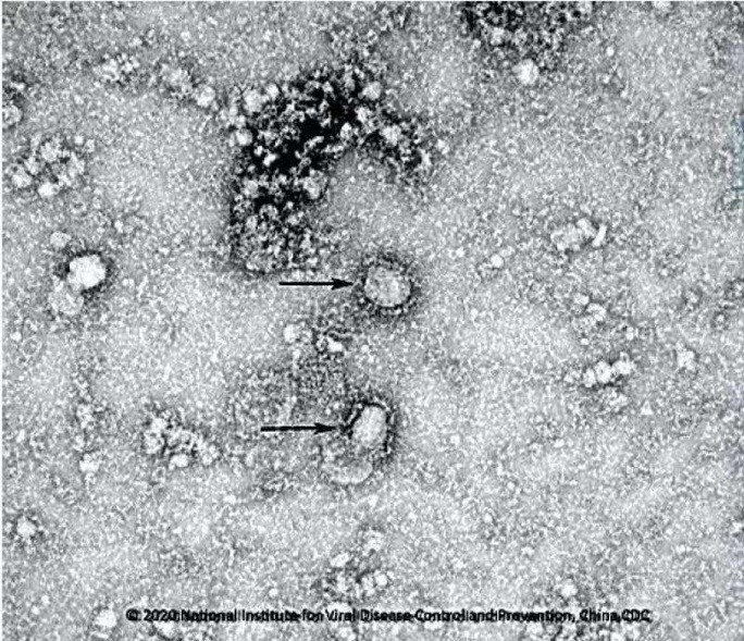 Trung Quốc công bố những hình ảnh đầu tiên của virus Vũ Hán - Ảnh 1.